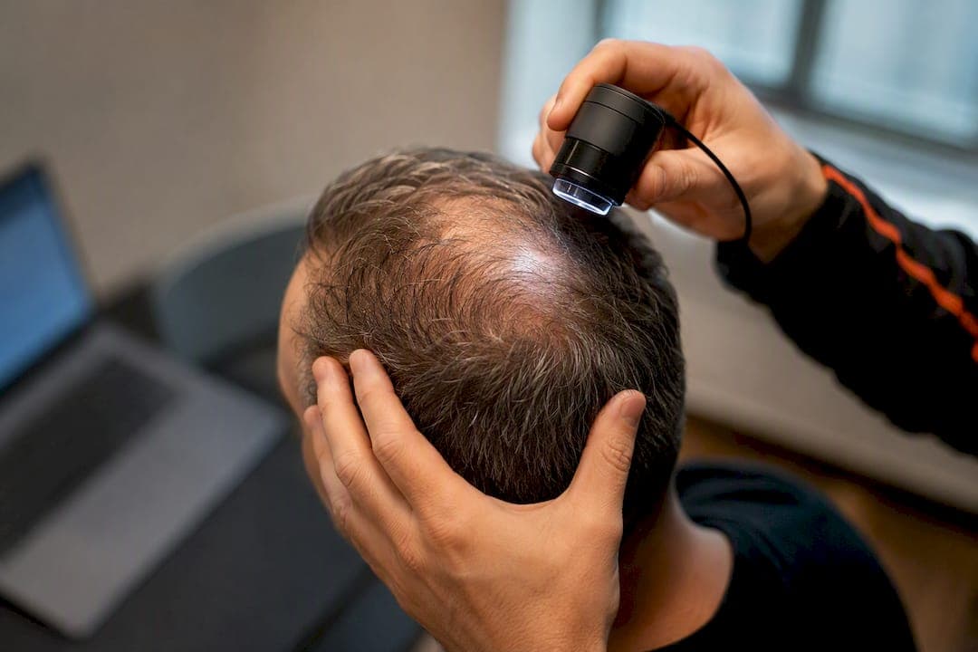 Lifters Over 40: 12 Week Trial Finds No Hair Loss From Creatine